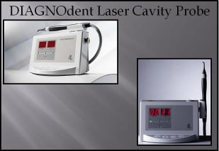 DIAGNOdent Cavity Detection Louisville Kentucky